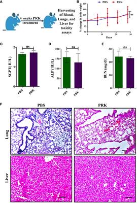 Antimycobacterial and healing effects of Pranlukast against MTB infection and pathogenesis in a preclinical mouse model of tuberculosis